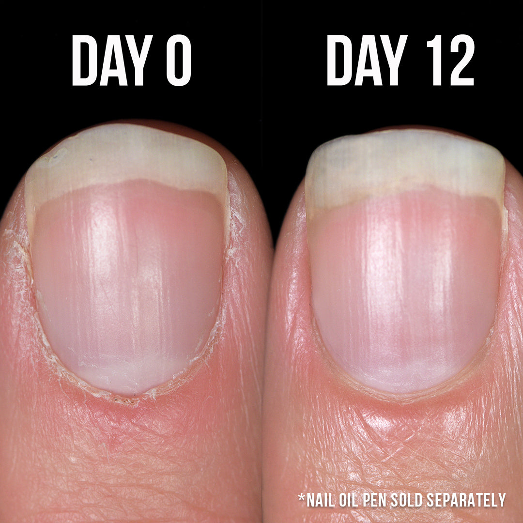 Watermelon Nail Oil Cartridges - 2pk